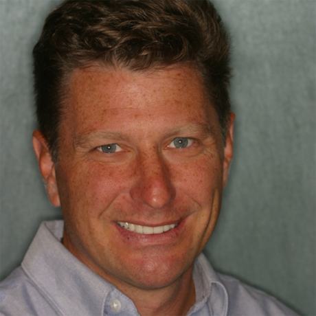 Loren West
